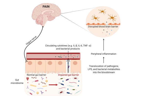 Microglia-Microbiome Review Figure 2